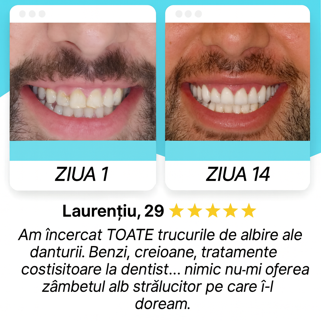 FreshSmile™ Ultra – zâmbet mai alb în 30s